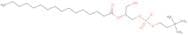 2-Palmitoyl-sn-glycero-3-phosphocholine