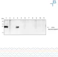 Anti-Cache Valley Virus (CVV) Nucleocaps - 1mg/mL
