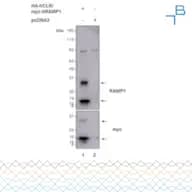 Anti-RAMP1 antibody