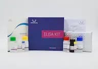Human SPTA1(Spectrin α chain, erythrocytic 1) ELISA Kit