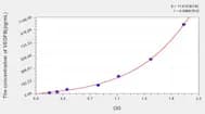 Rat VEGFB(Vascular Endothelial Growth Factor B) ELISA Kit