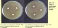 Mueller Hinton Agar (MH Agar)