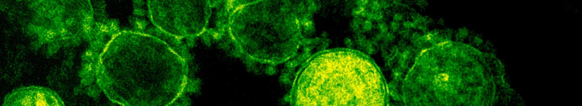 Le rôle des anticorps en immunologie : diversité, fonctions et pertinence