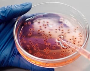 Journée mondiale de la sclérose en plaques : une opportunité pour sensibiliser et éduquer sur cett…