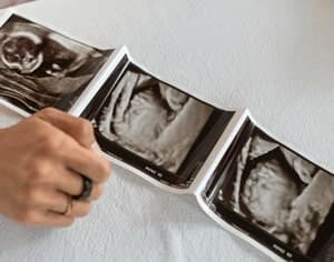 4 juin, Journée Mondiale de la Fertilité