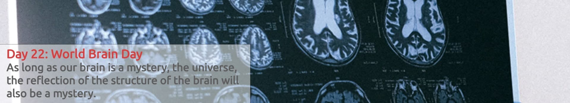 22 juillet. Journée mondiale du cerveau