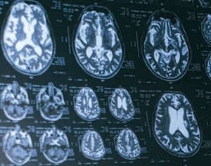 22 juillet. Journée mondiale du cerveau